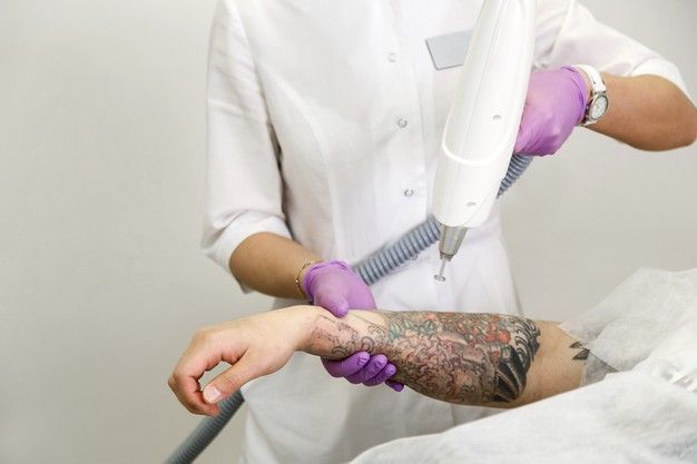 Comprehensive Training Programs for Tattoo Removal Professionals