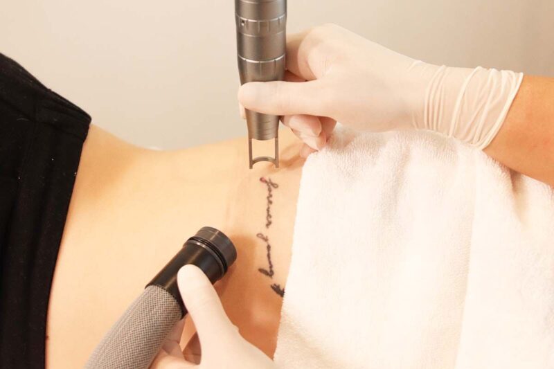 Key Skills and Knowledge in Tattoo Removal Training