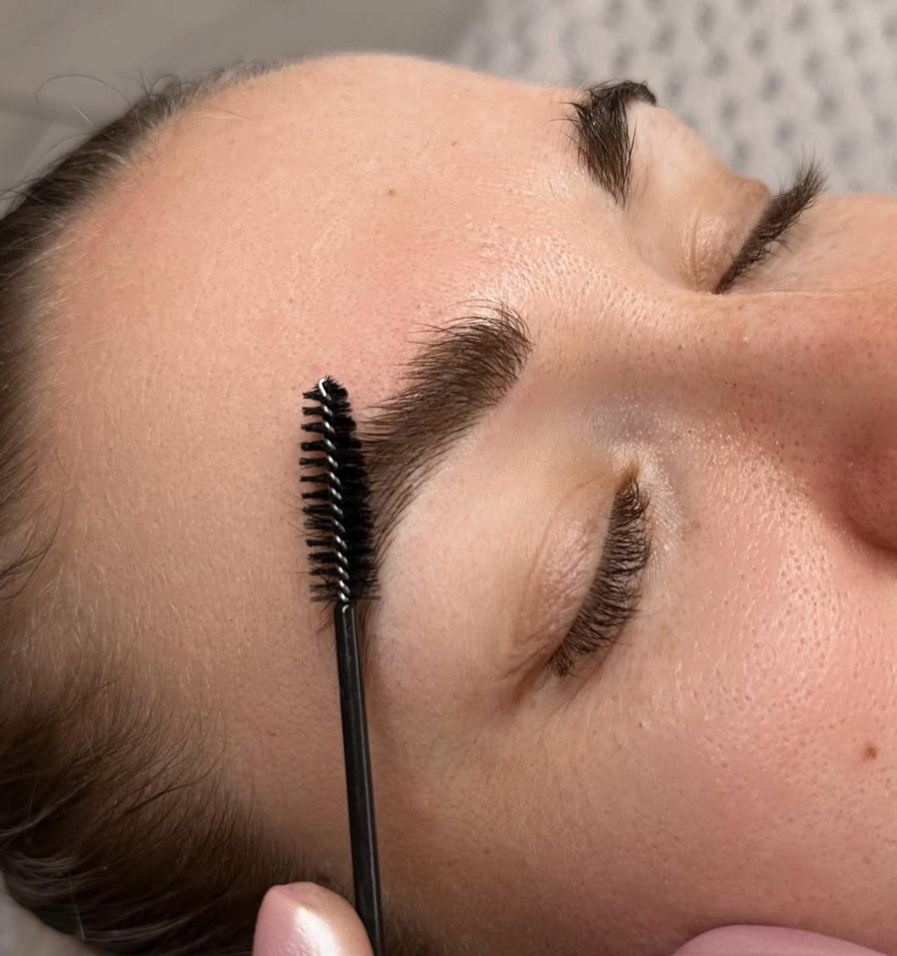 alopecia combo brows before after