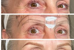 before after combination brow shading large pores