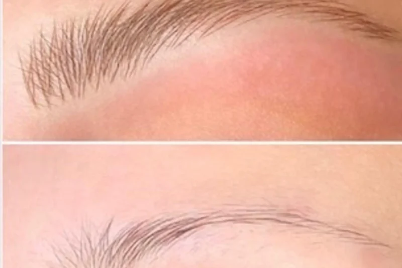 Halo Effect Iron Oxide Eyebrow Tattoos: Why Older Brows Glow Under UV Or Blue Light