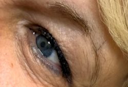 before and after combination brow coverup