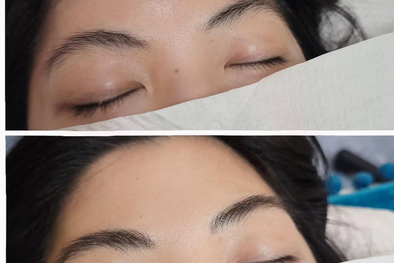 Combination Brows Price Sydney Melbourne: What You Should Really Pay