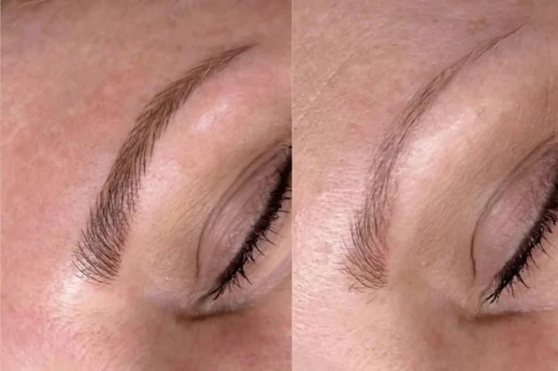 Will My Eyebrow Tattoo Pigment Interact With My Monthly Exosome Facial? (Quick Answer)