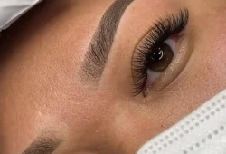 before and after saline removal forehead