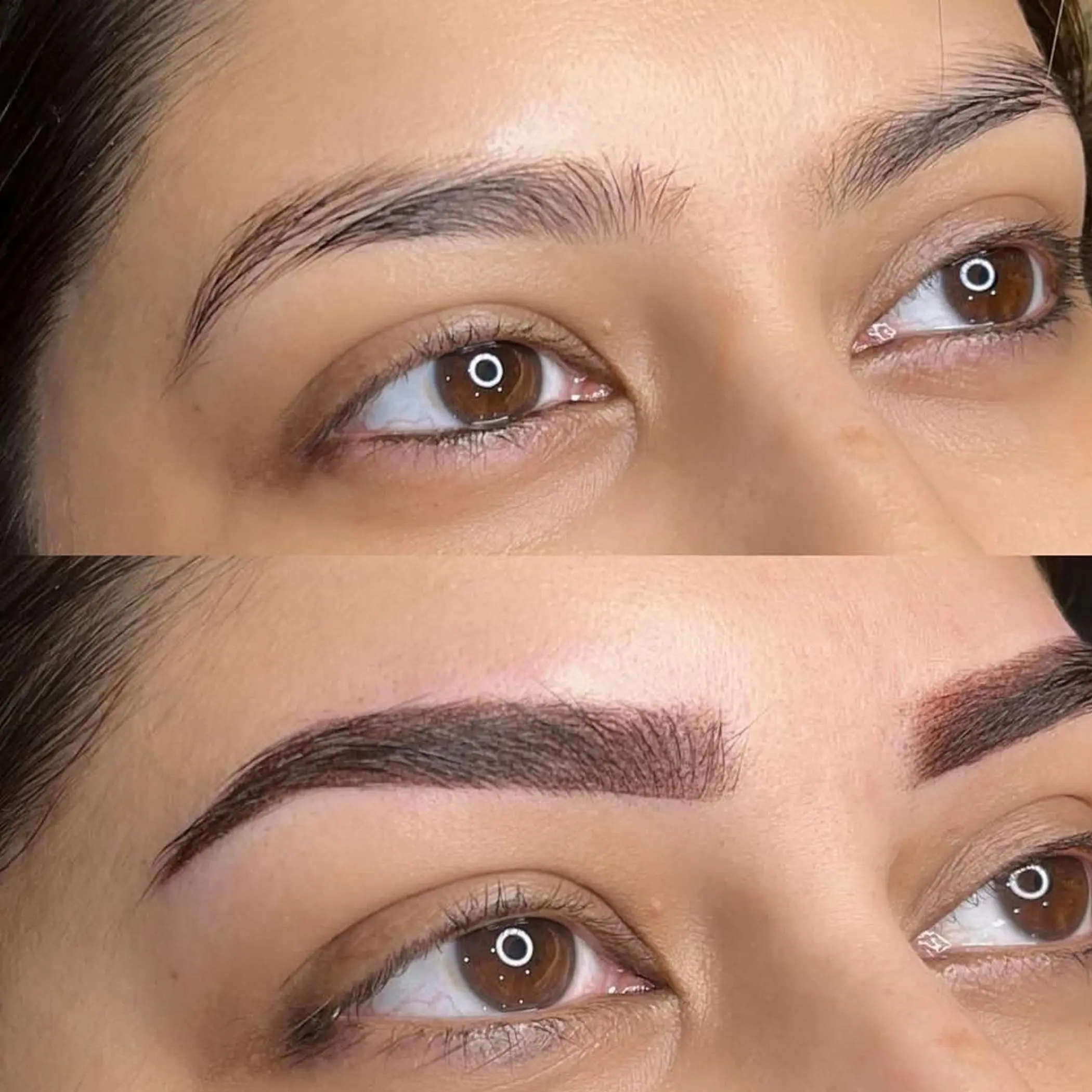 close up of scarred forehead skin texture