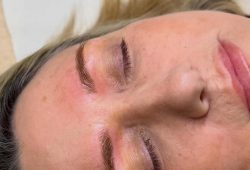 combo brows before and after healing
