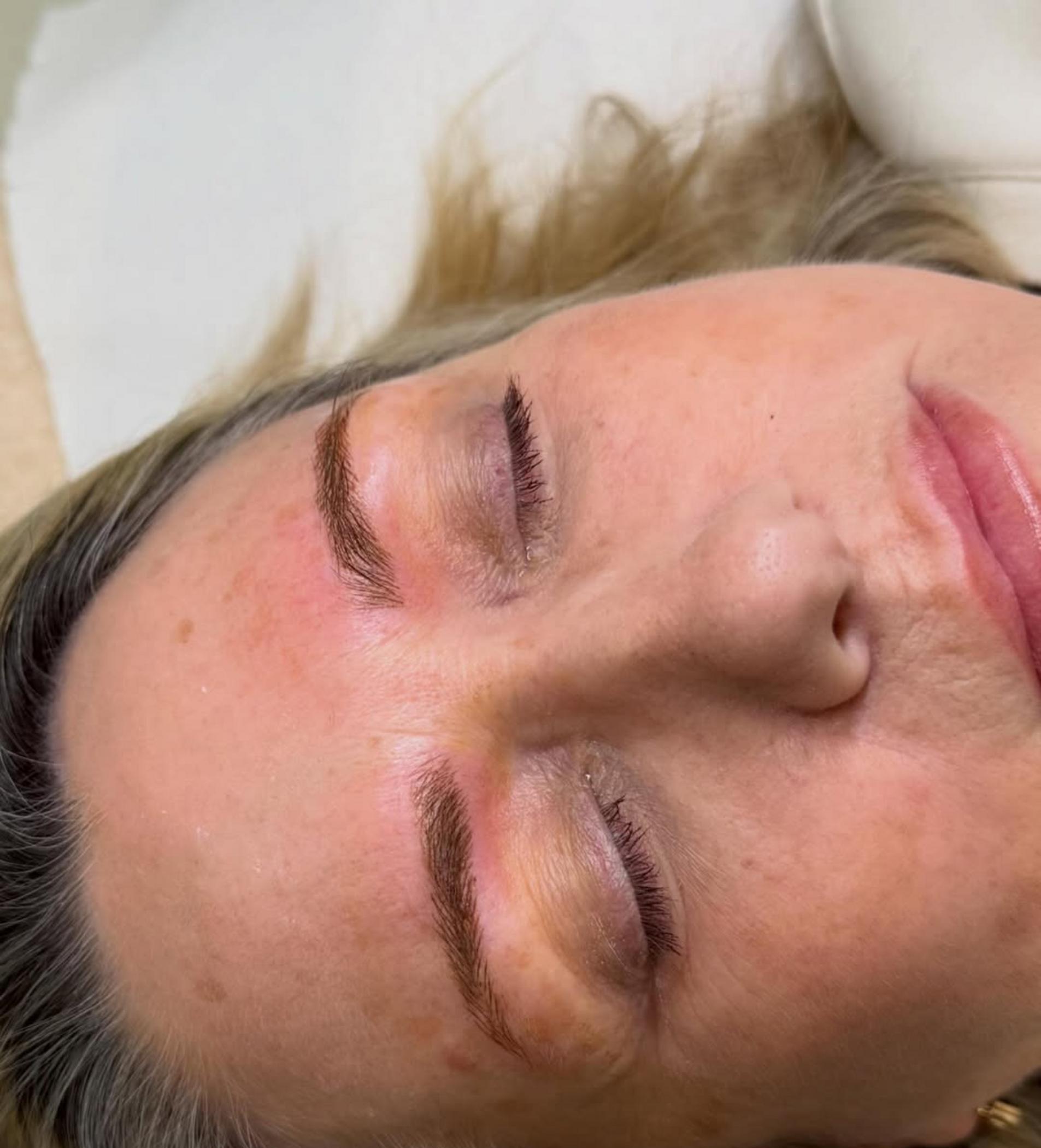 combo brows before and after healing