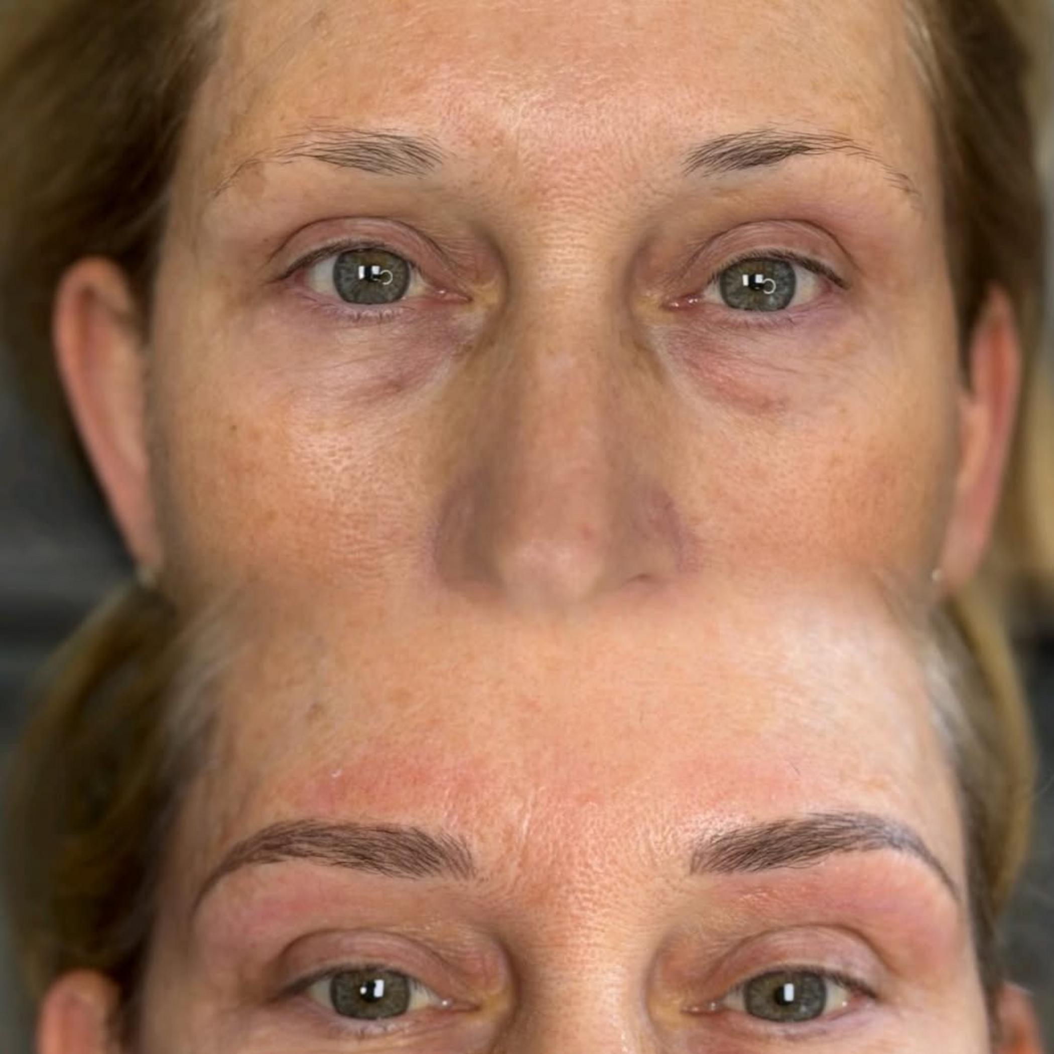 eyebrow tattoo procedure in progress
