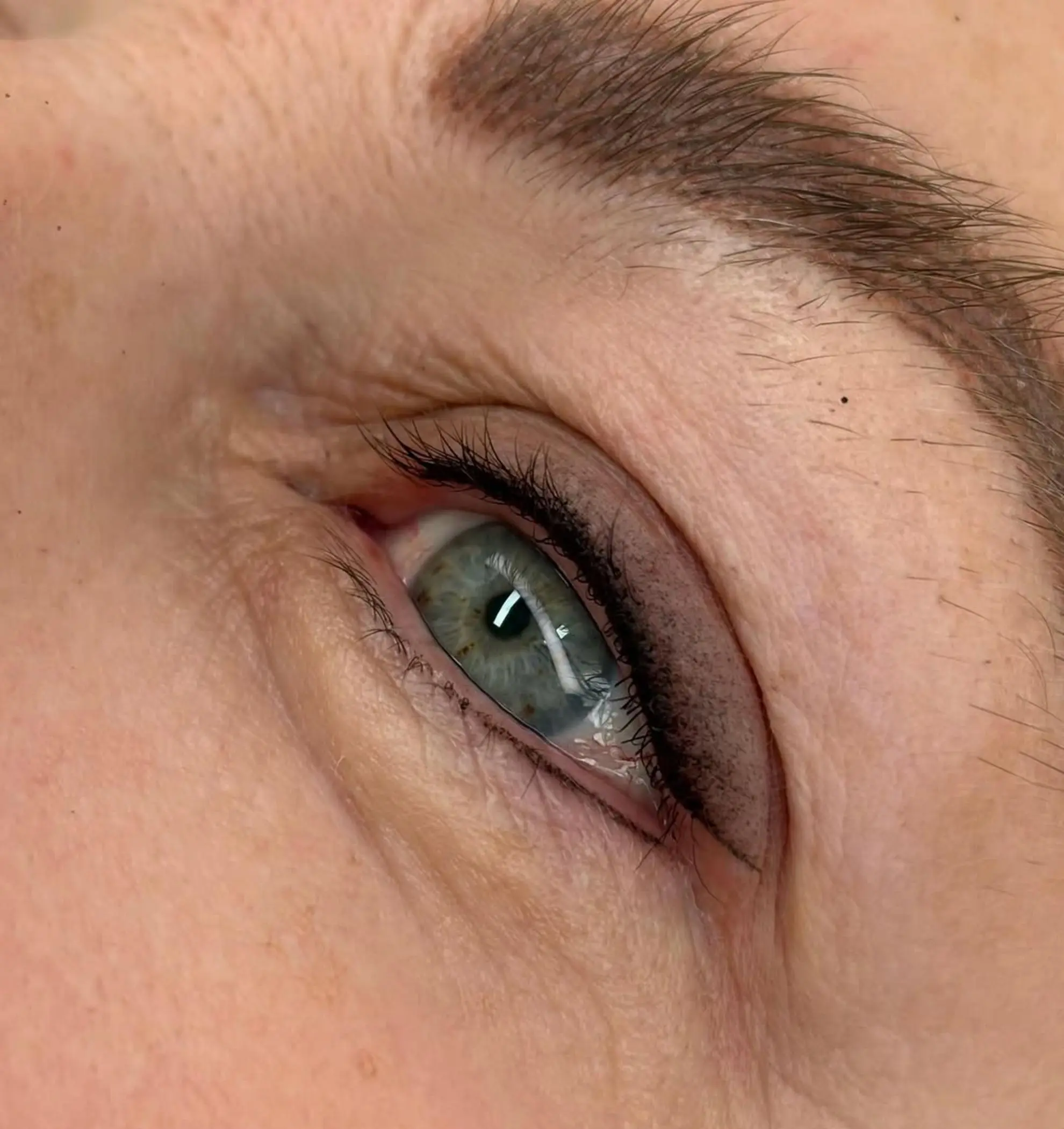 eyebrow tattoo removal process session