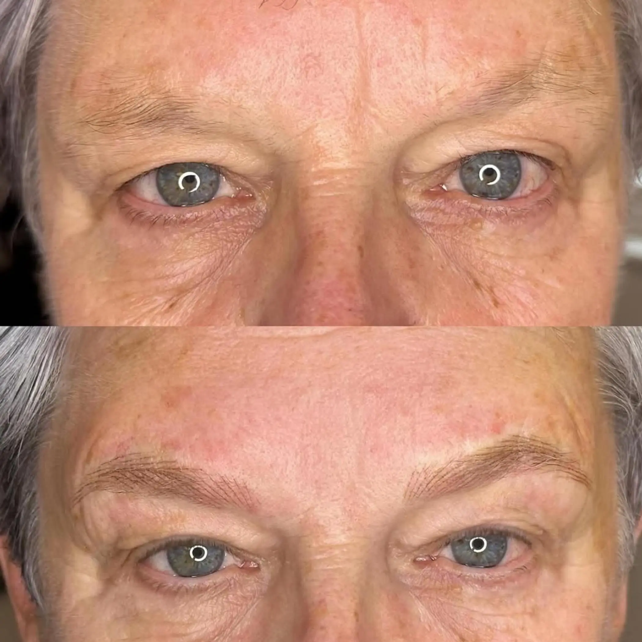 healing phase subtle brow flaking