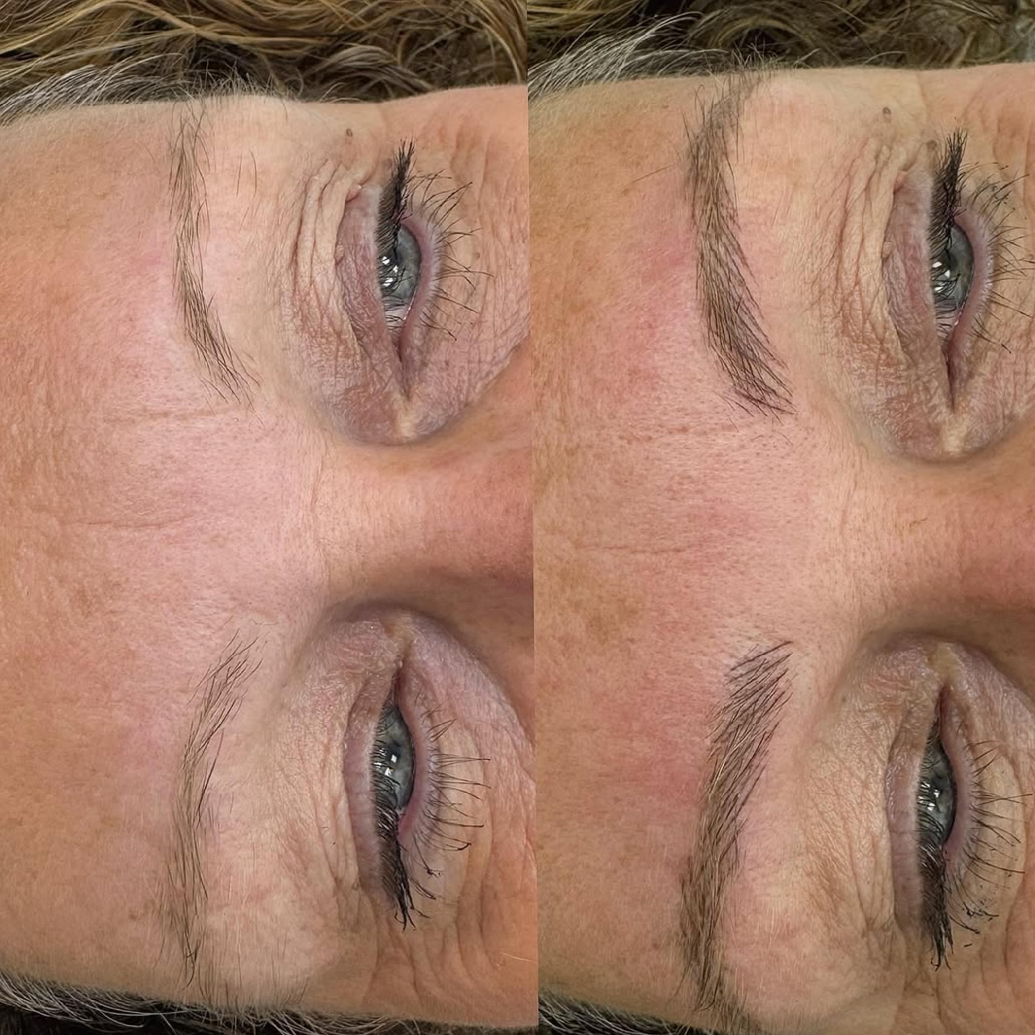 healing stage fresh combo brow redness