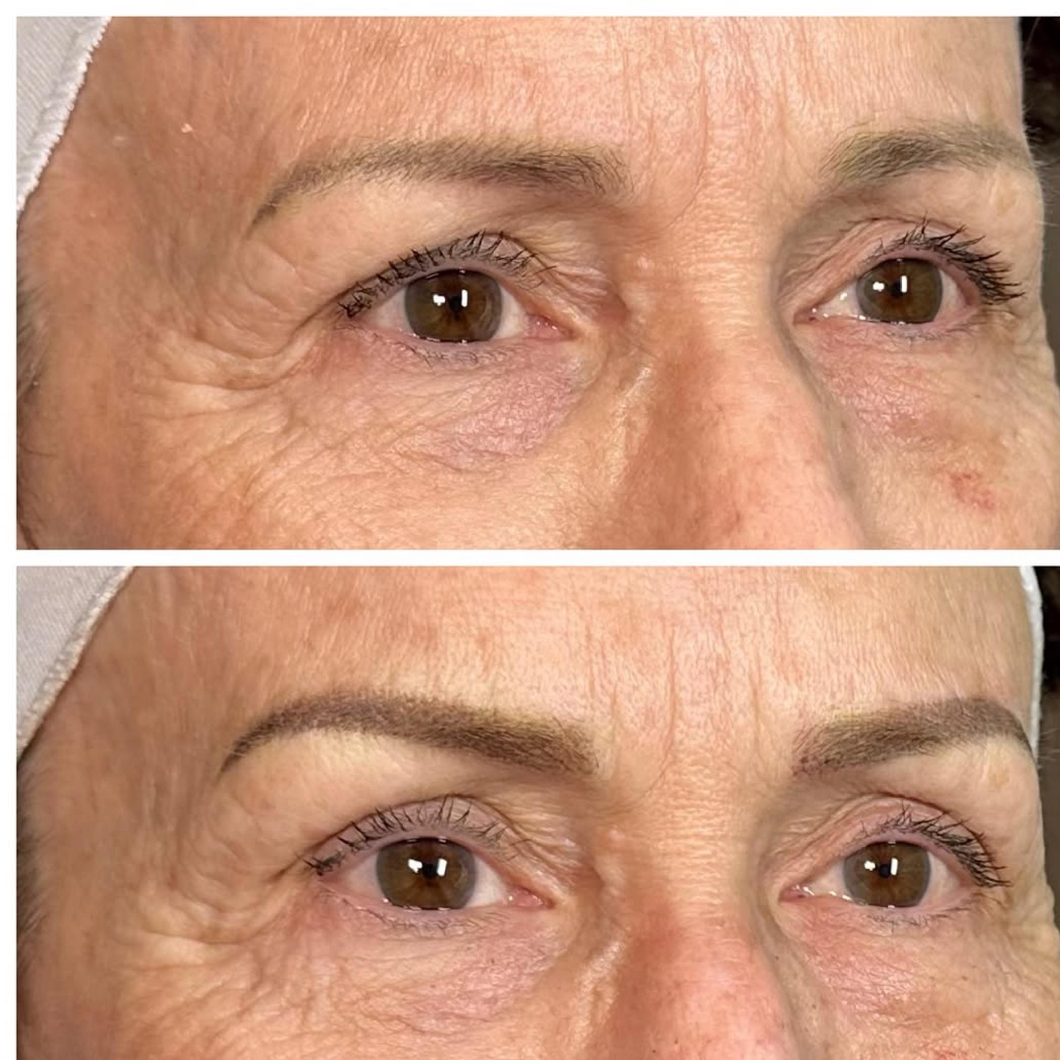 healing stage two combination brows oily skin
