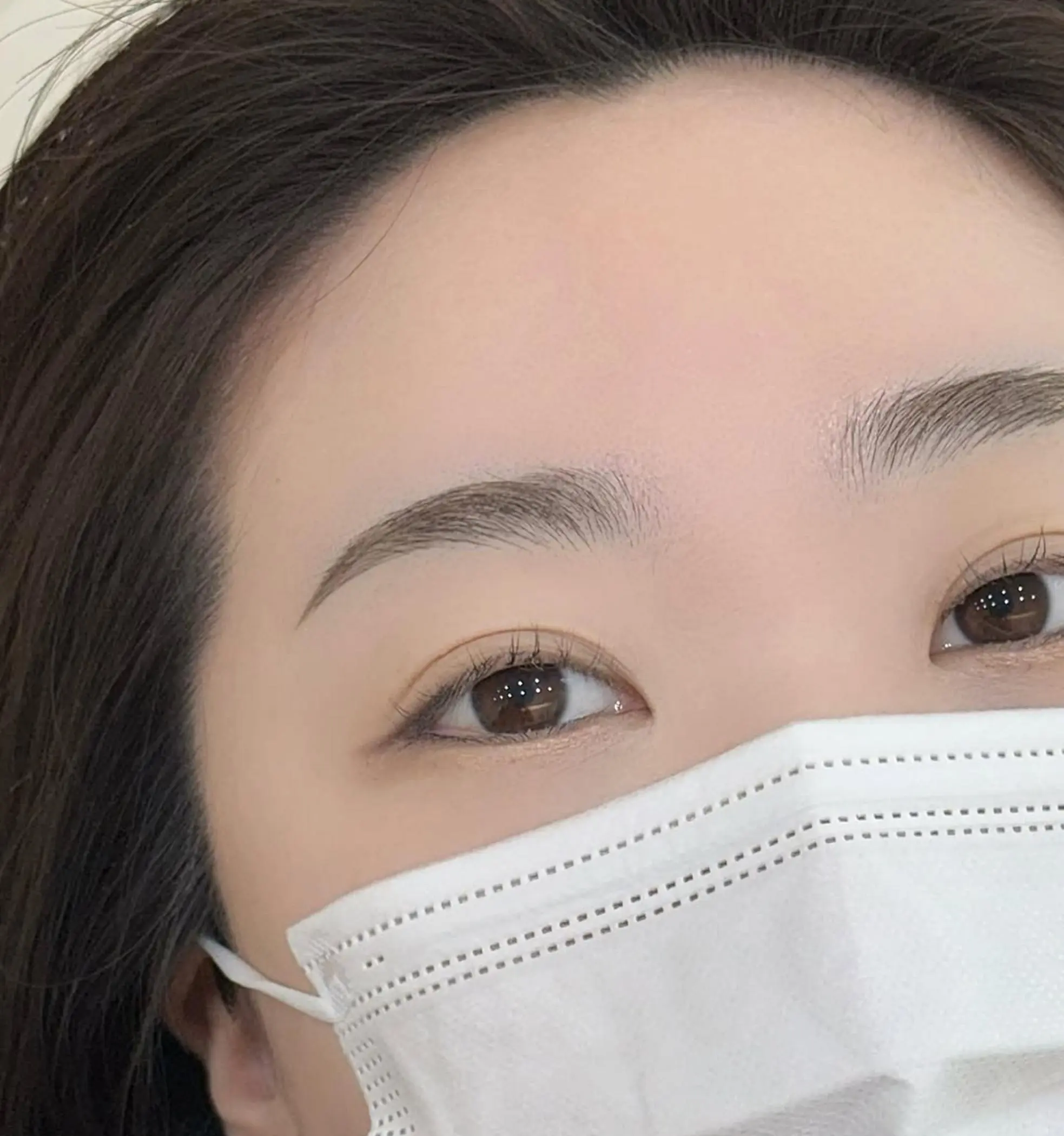 healing stages thin forehead skin after removal